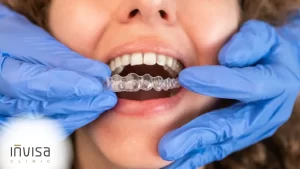 Dentista Especialista em Aparelho Ortodôntico Invisível