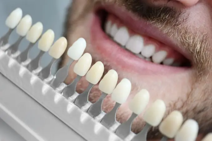 Lente de Contato Dental