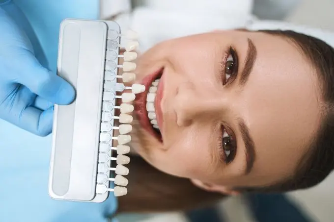 Diferença da Lente de Contato Dental de Porcelana e de Resina em São Paulo - SP