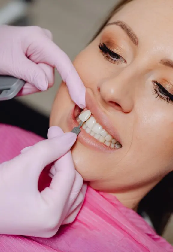 Dentista especialista em faceta dental