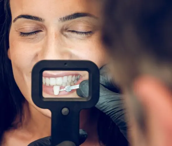 Dentista Especialista em Lente de Contato Dental