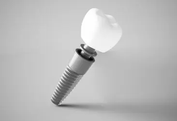 Implante Dentário