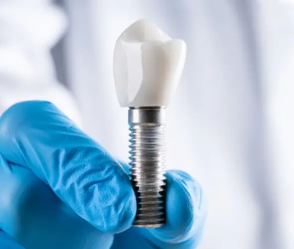 Clínica de implante dentário em São Paulo