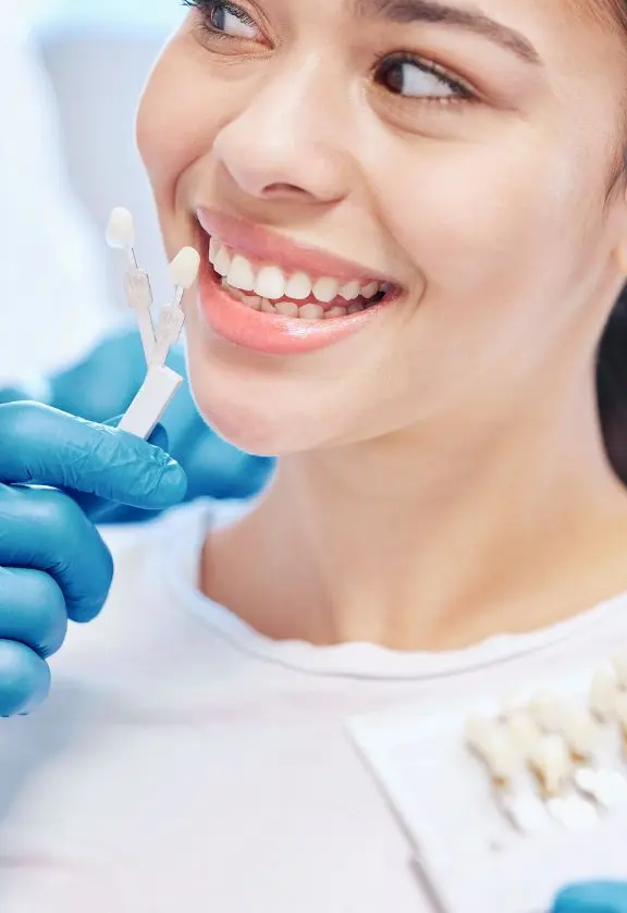 Lente de Contato Dental em Moema São Paulo SP