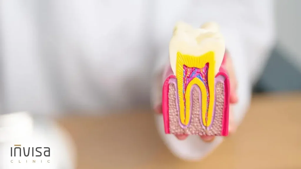 Esquema do ligamento periodontal e da remodelação óssea durante a biomecânica do alinhador invisível