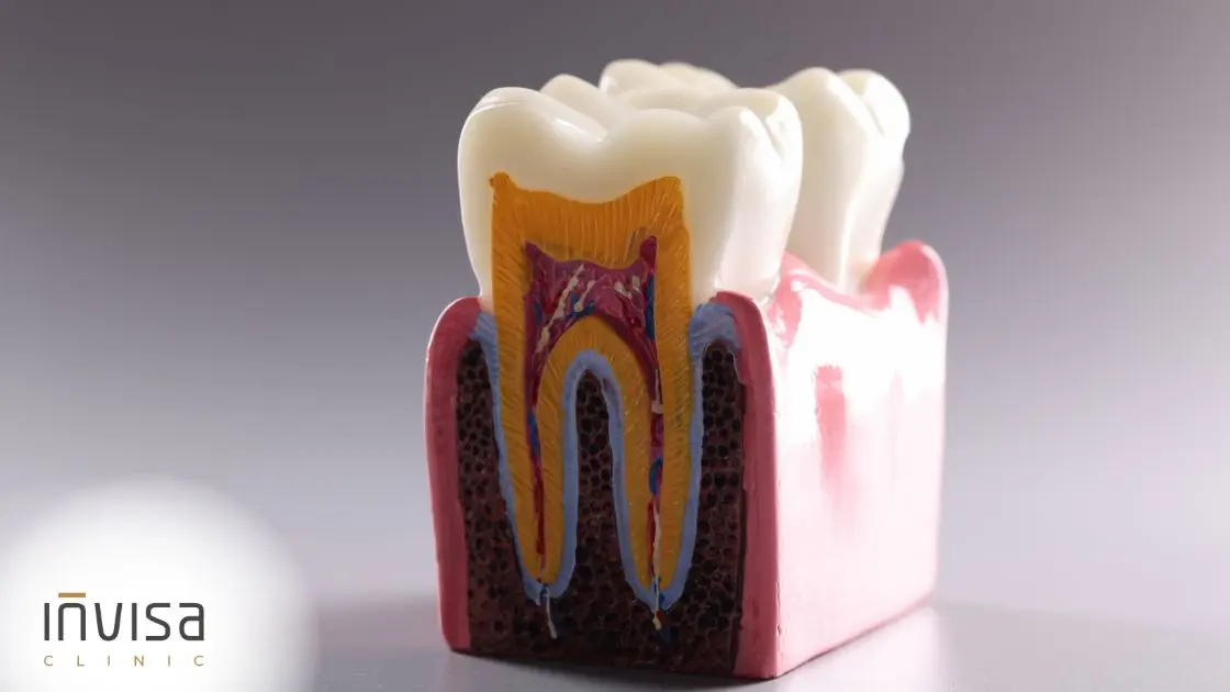 Esquema biológico de como o alinhador movimenta o dente pelo ligamento periodontal e osso alveolar.