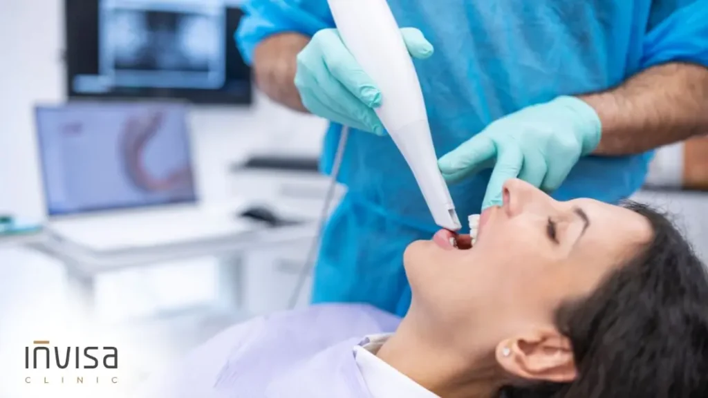 Escaneamento intraoral 3D no planejamento de como o alinhador movimenta o dente na Invisa Clinic.