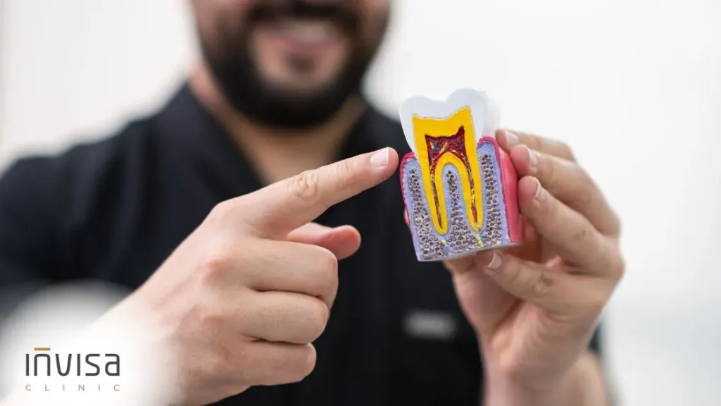 Esquema anatômico do mostrando esmalte e dentina